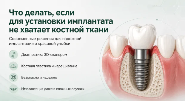 Картинка статьи